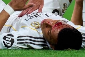 阿斯报：西甲方面否认转播故意不拍姆巴佩流血镜头